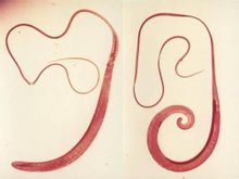 Whipworm